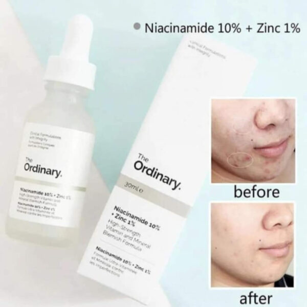 The Ordinary Niacinamide 10%+Zinc1% (Made in Canada ) - Image 3